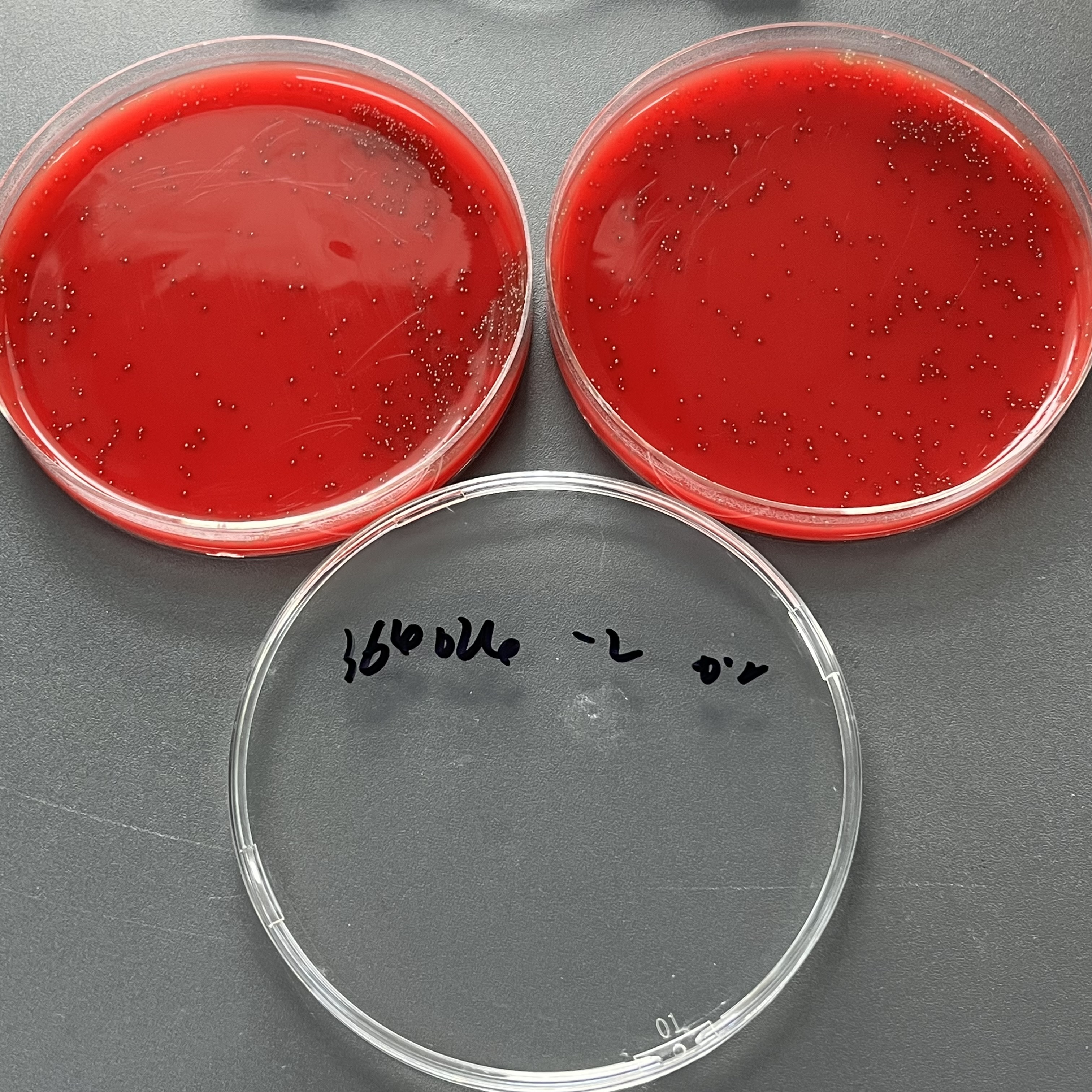 Quantitative strain of Streptococcus pyogenes-BNCC