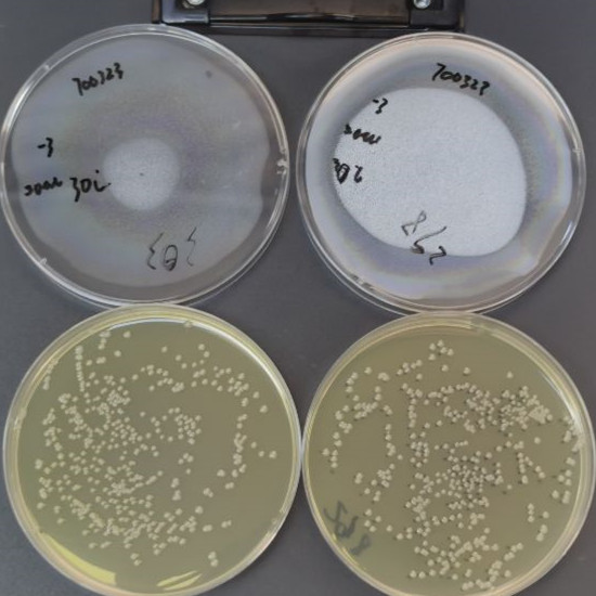 Quantitative strain of Escherichia coli-BNCC