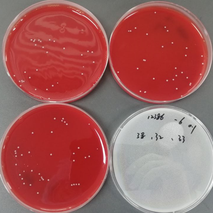 Quantitative strain of Streptococcus agalactiae-BNCC
