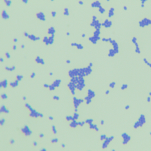 Quantitative strain of Streptococcus agalactiae-BNCC