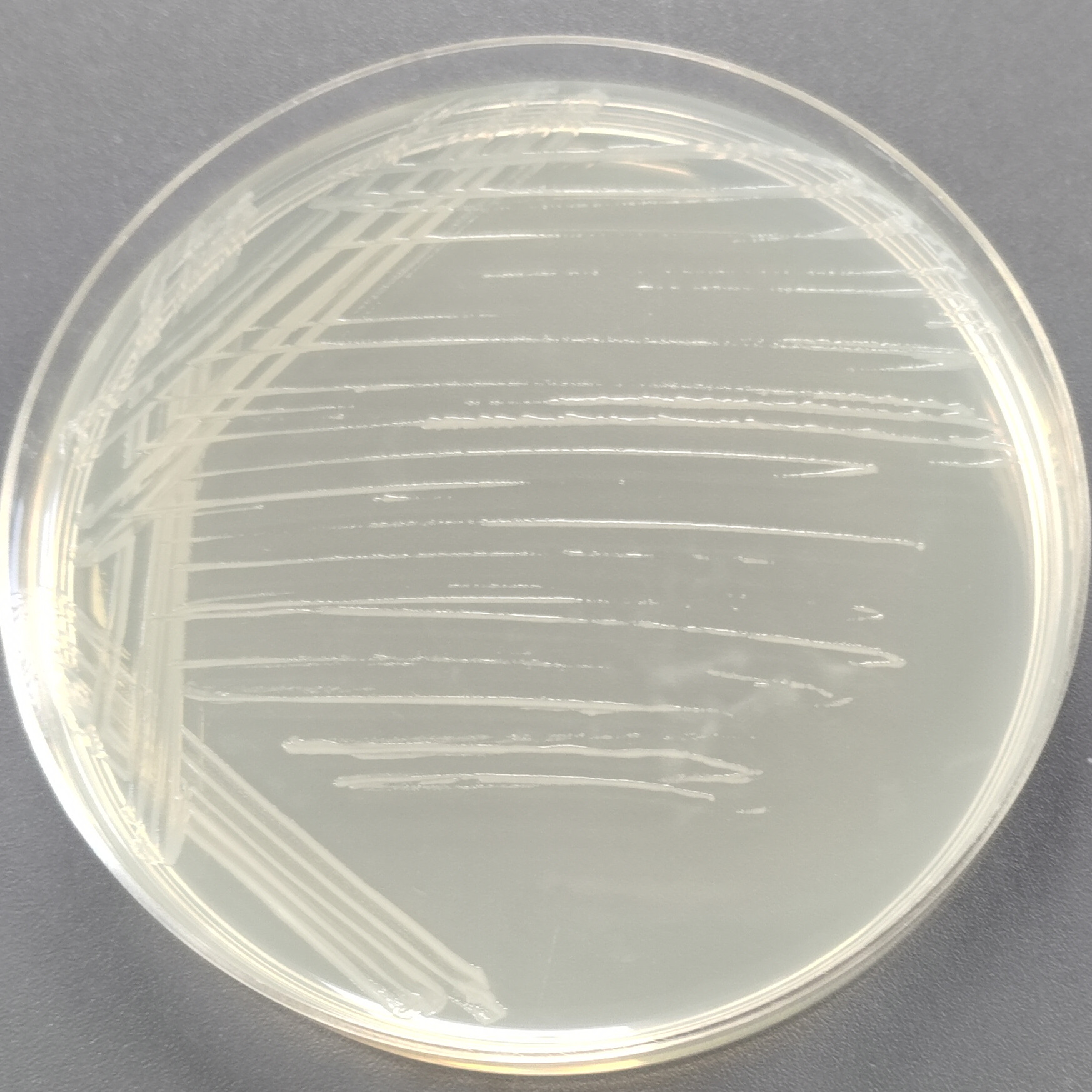 Rosetta-gami2 (DE3) Escherichia coli-BNCC