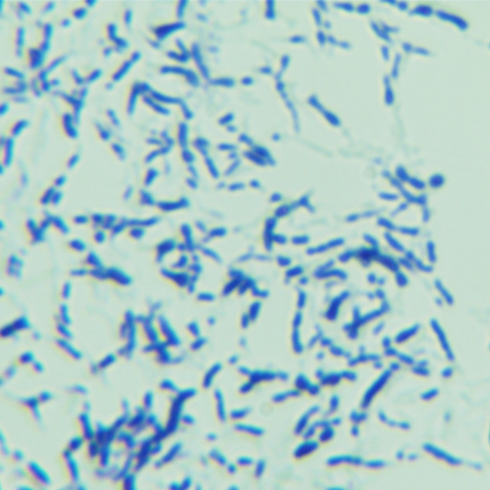 Bifidobacterium bifidum-BNCC