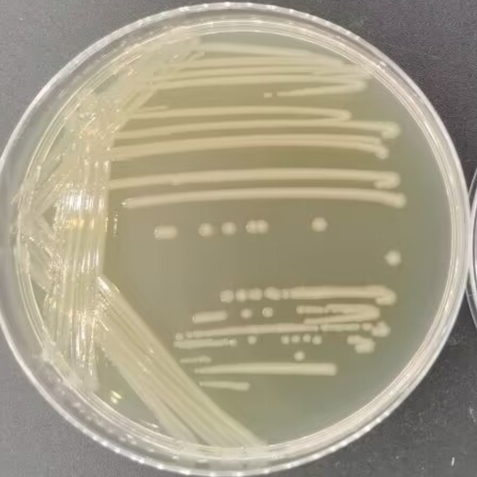 Escherichia coli-BNCC