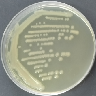 Escherichia coli-BNCC