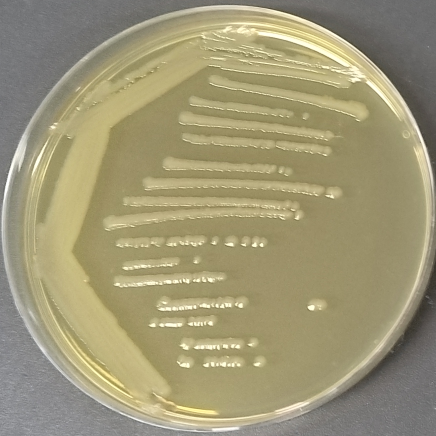Escherichia coli-BNCC