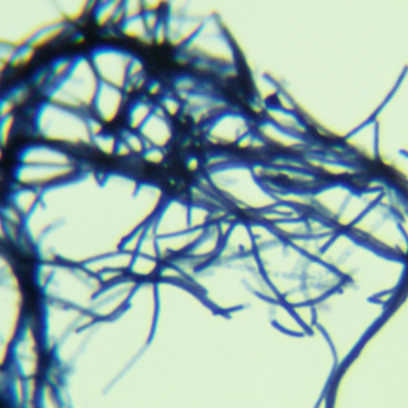 Streptomyces-BNCC