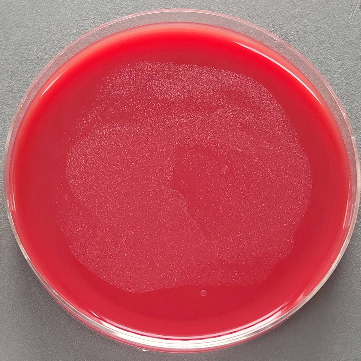 Helicobacter pylori-BNCC