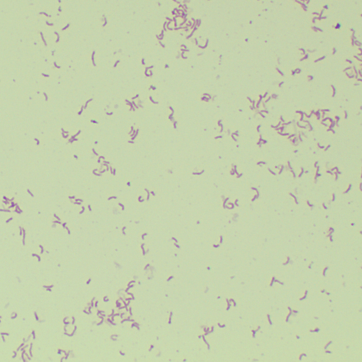 Helicobacter pylori-BNCC