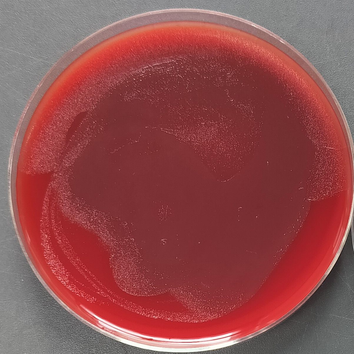 Helicobacter pylori-BNCC
