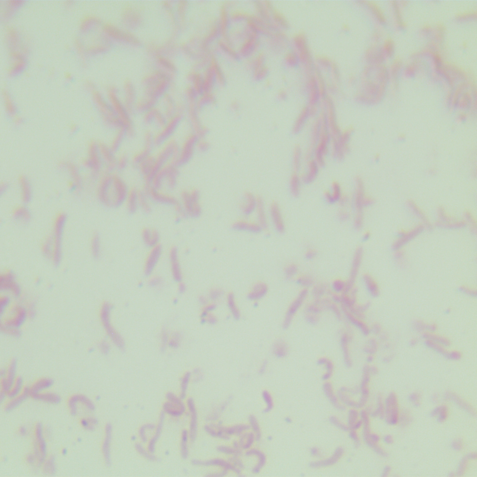 Helicobacter pylori-BNCC
