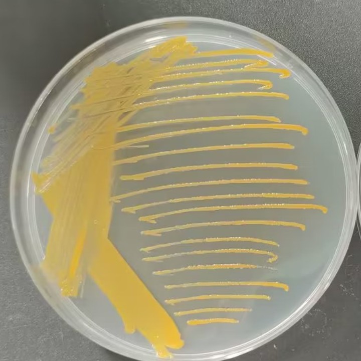 Mycobacterium genus-BNCC