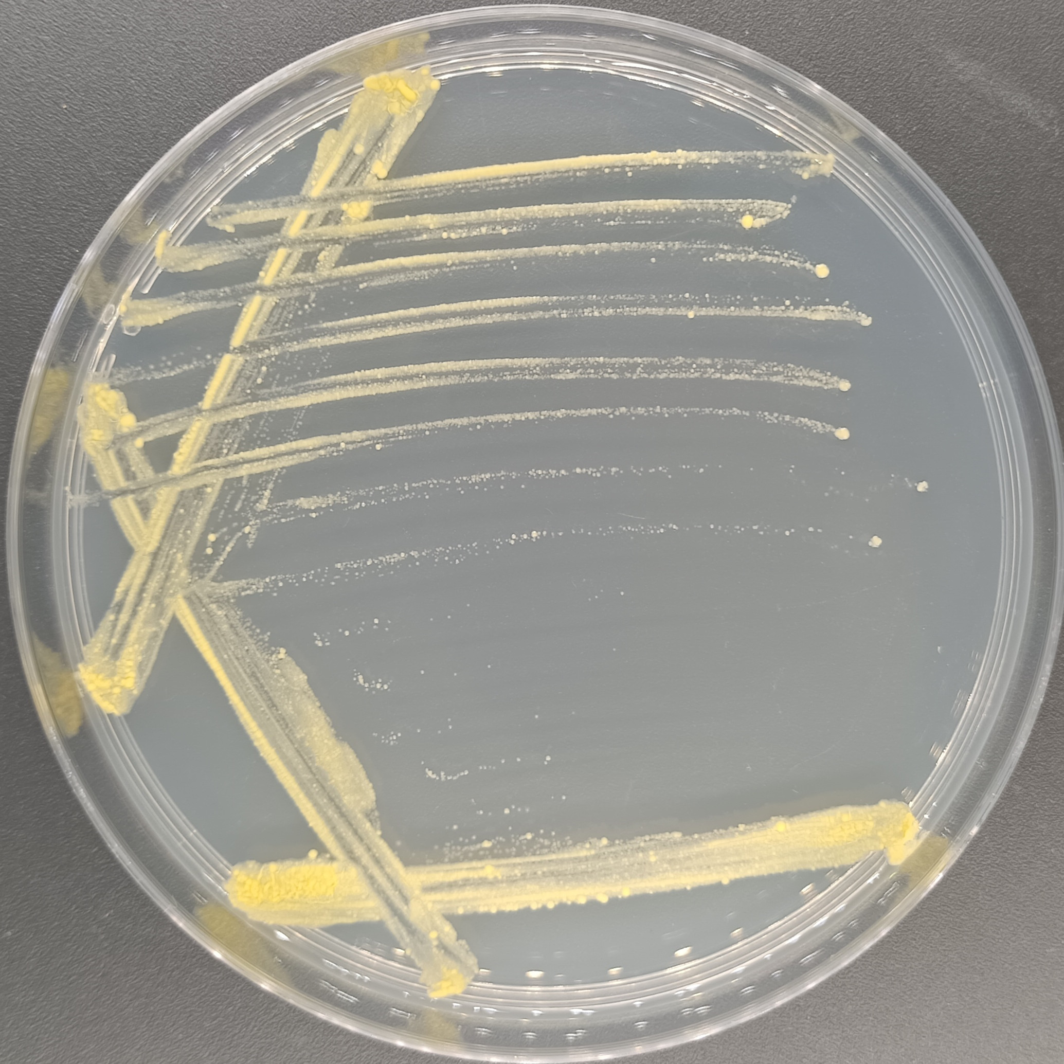Lyman mycobacteria-BNCC