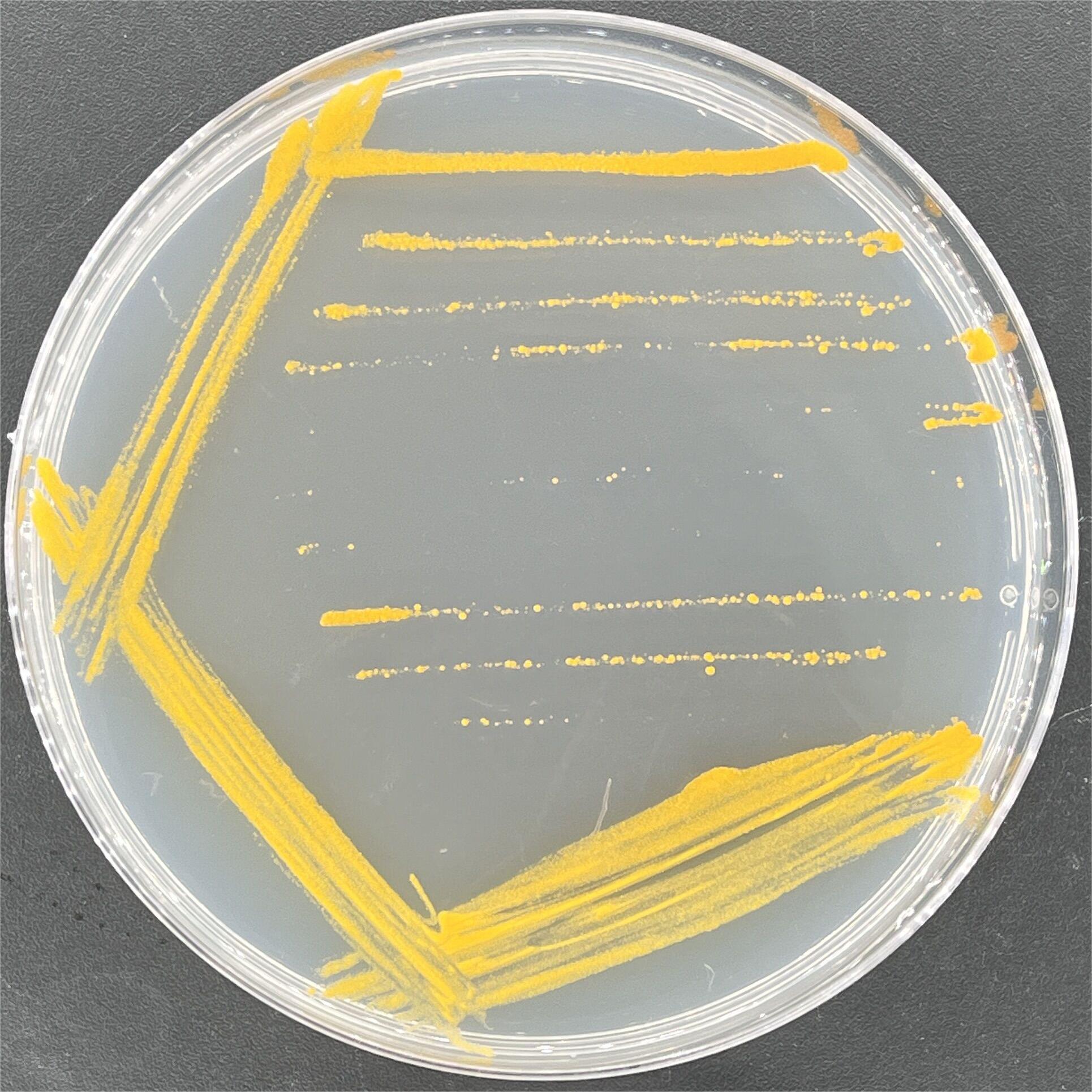 Mycobacterium genus-BNCC