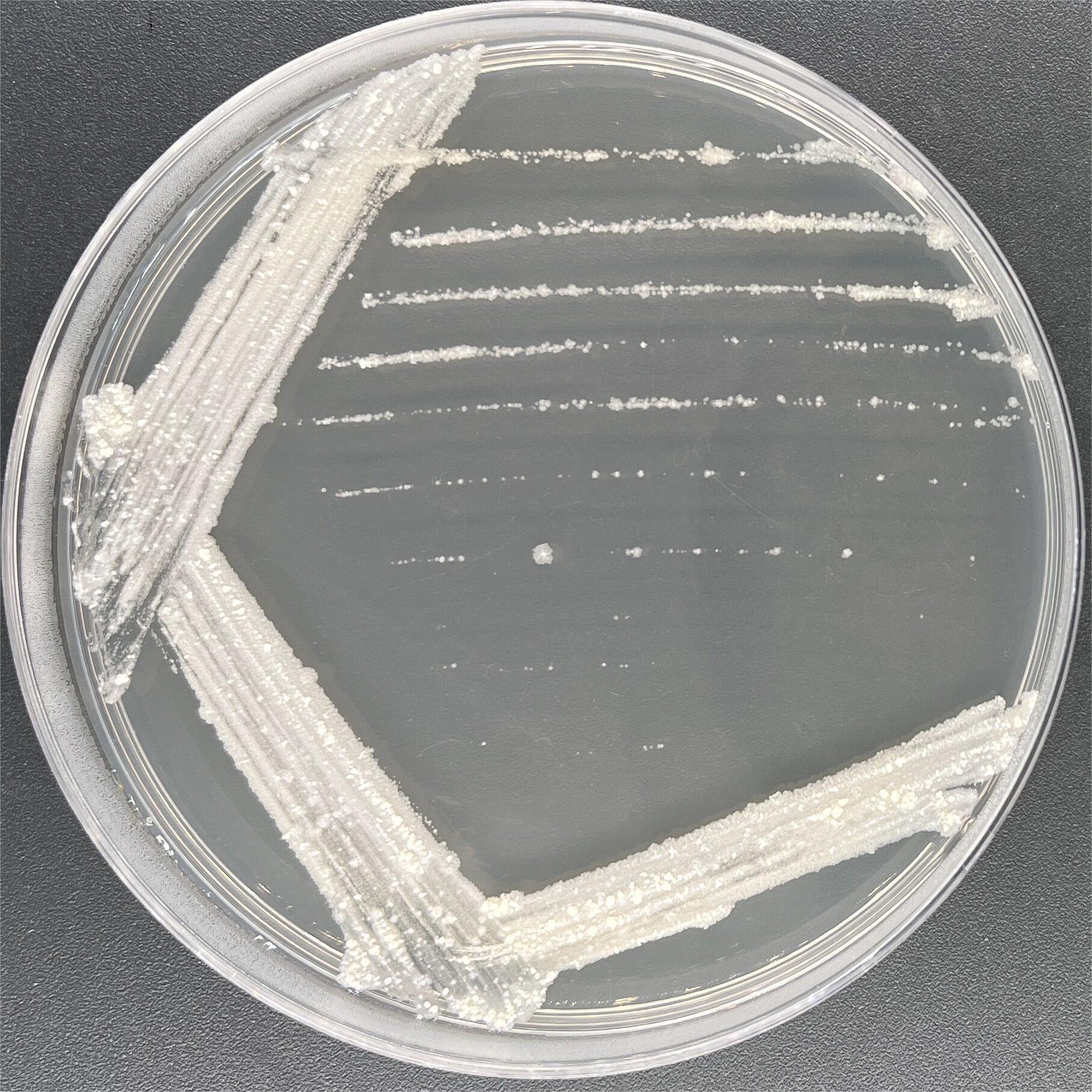 Mycobacterium smegmatis-BNCC