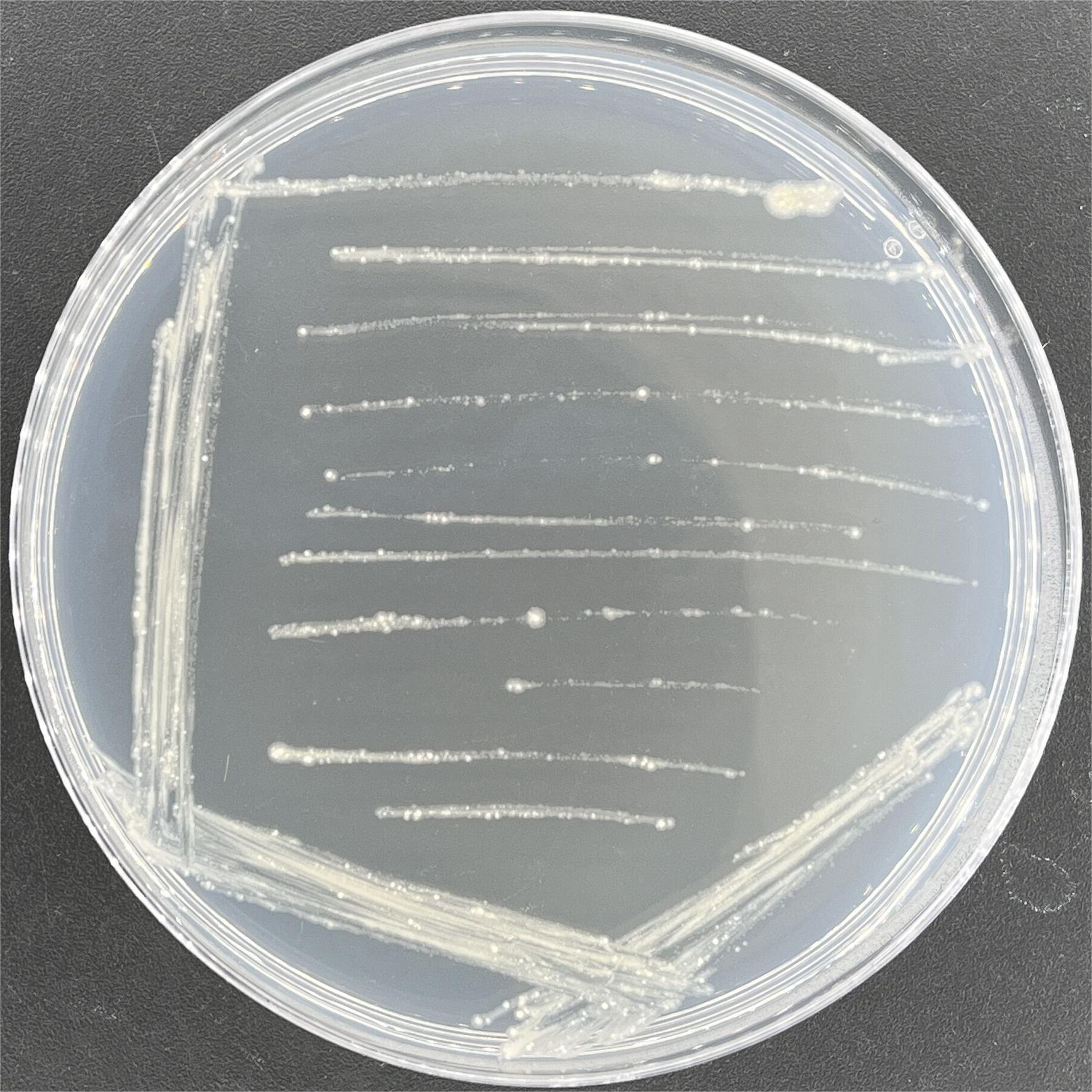 Mycobacterium difficile-BNCC