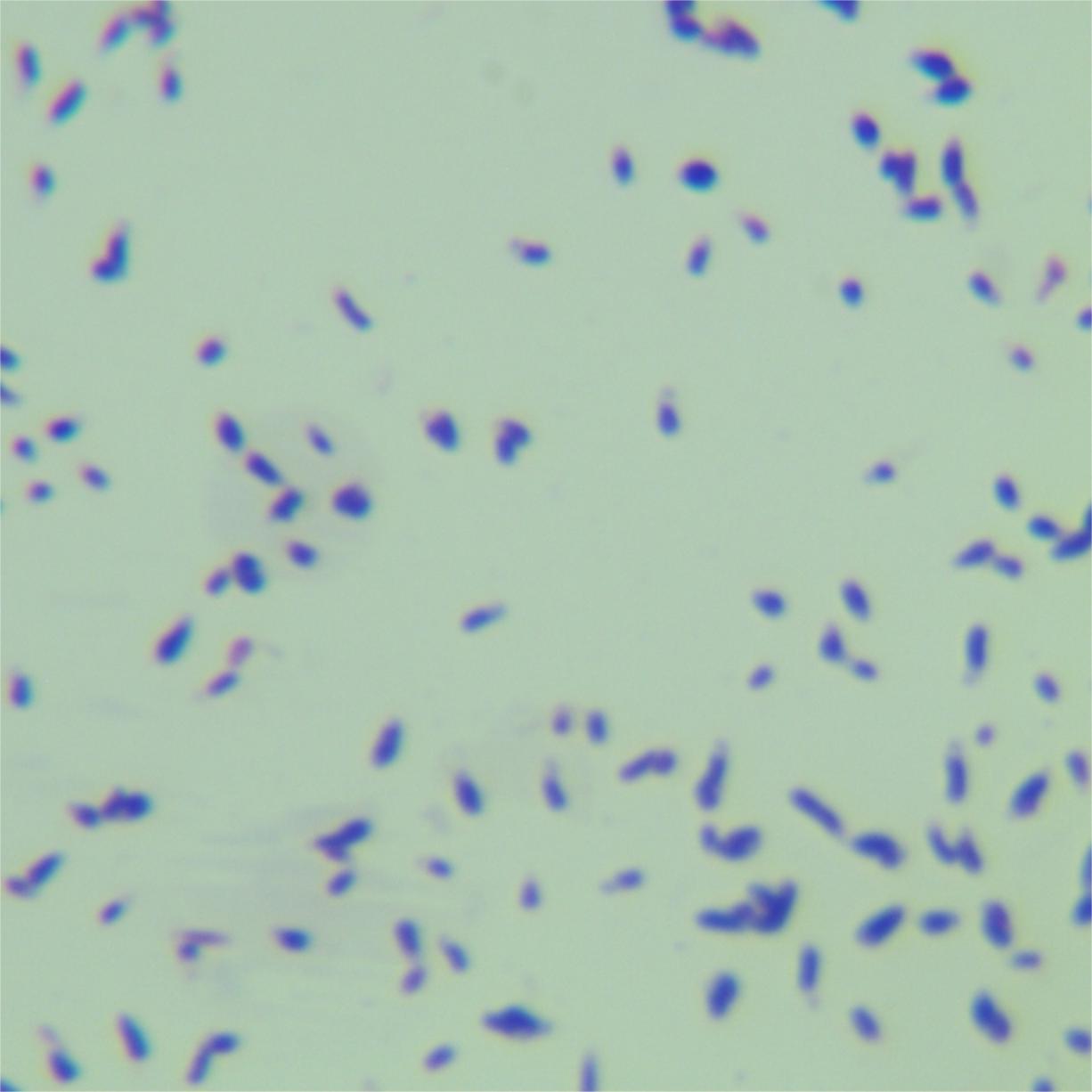 Mycobacterium difficile-BNCC