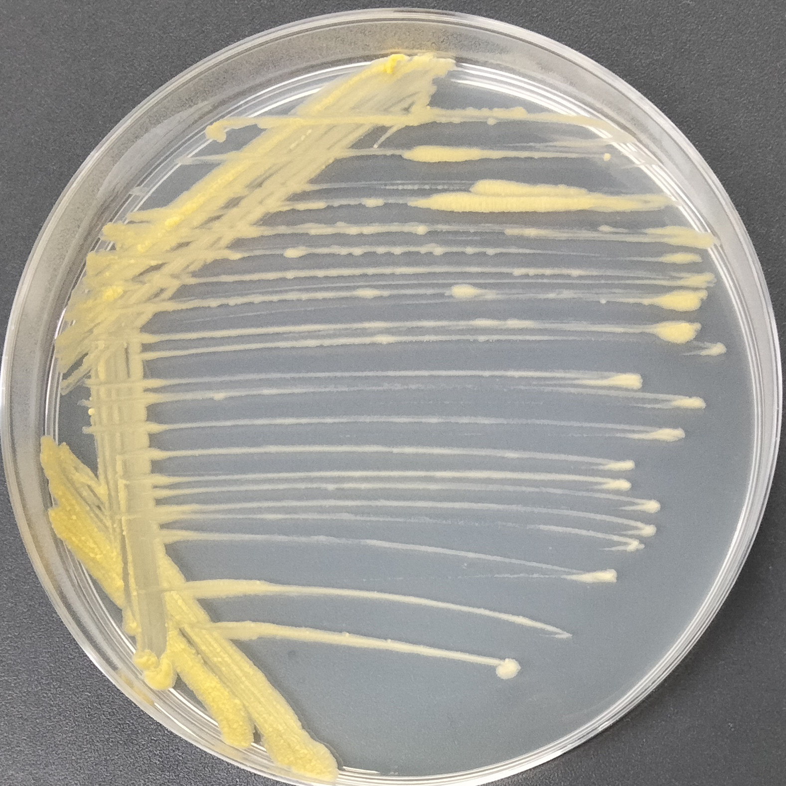 New ear mycobacteria-BNCC