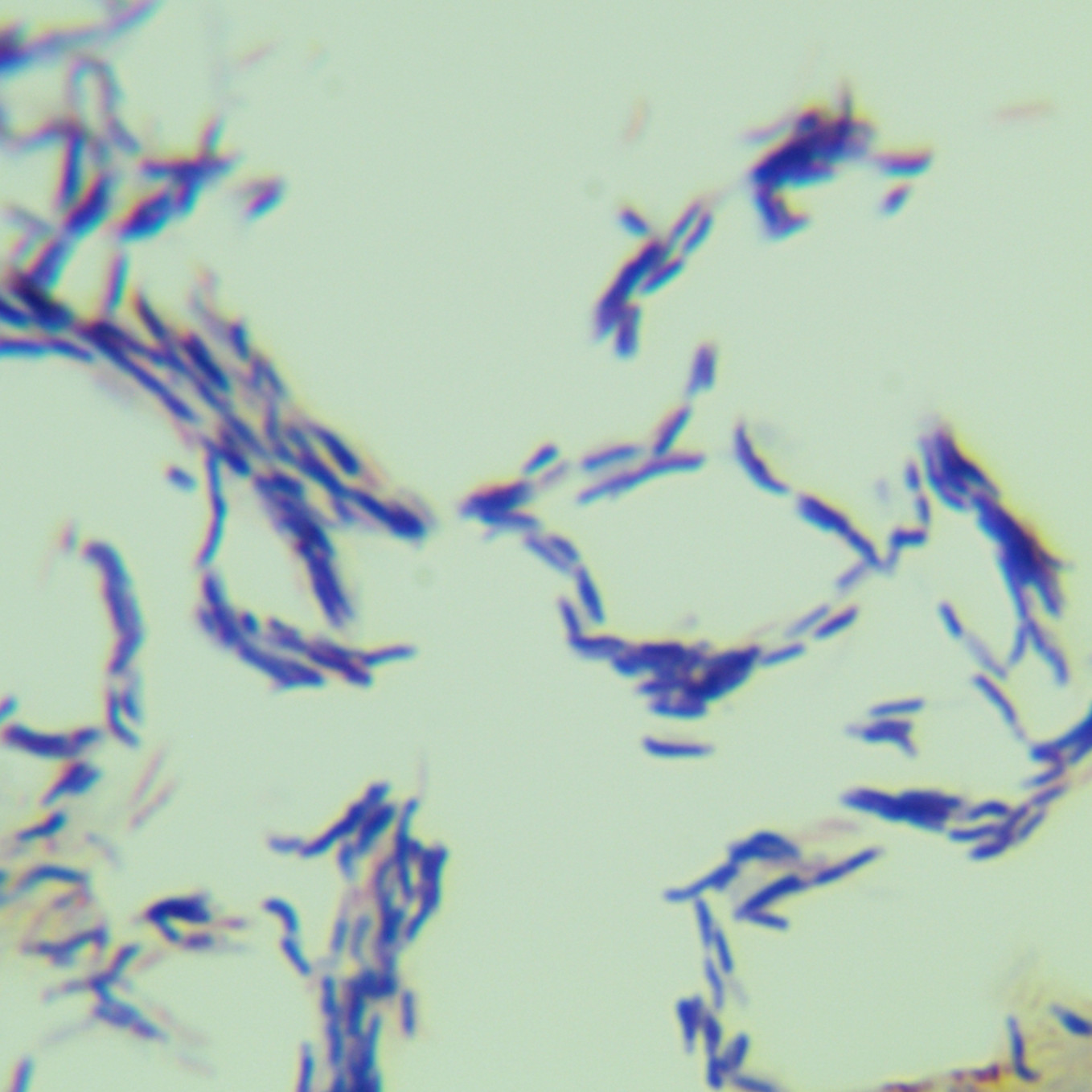 New ear mycobacteria-BNCC