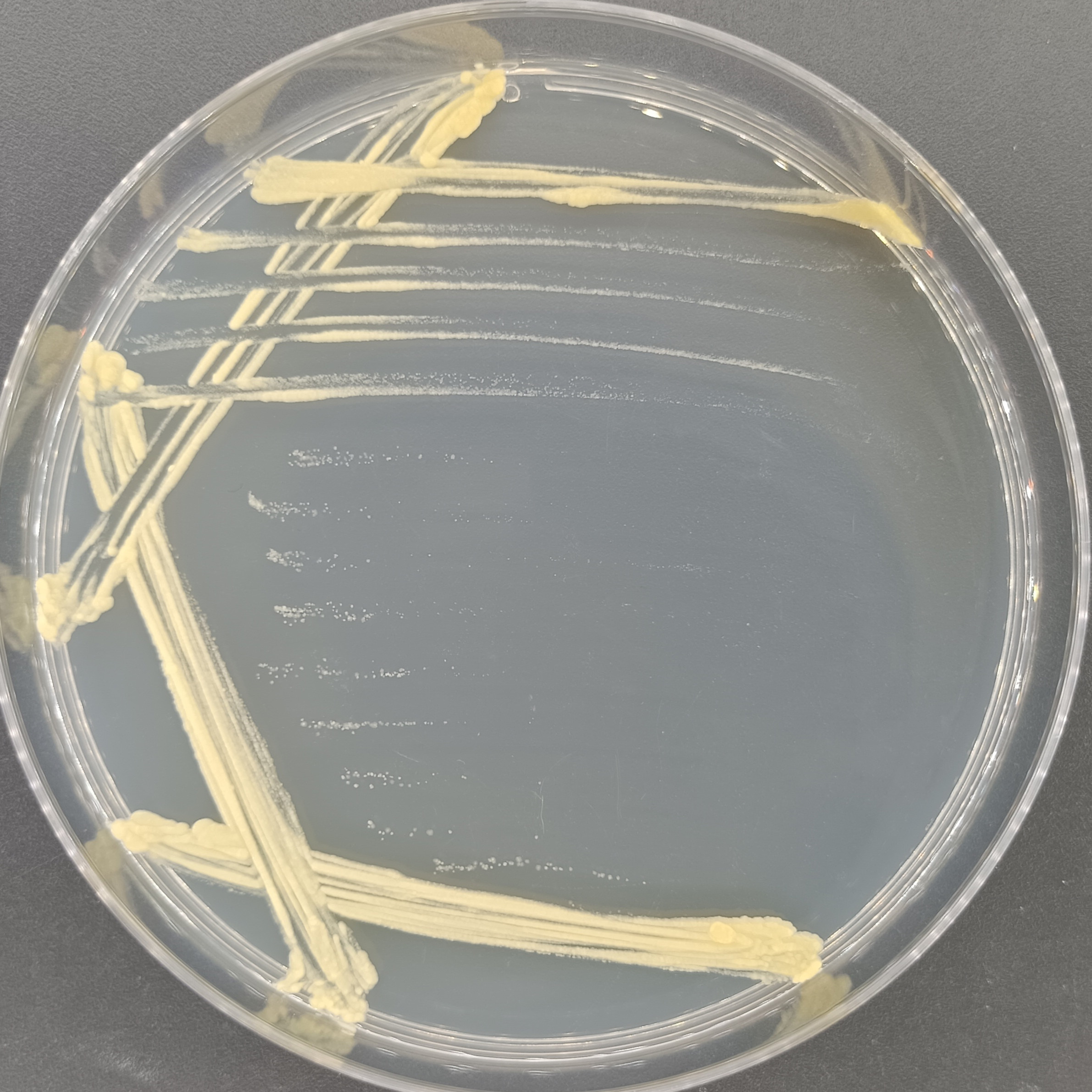 Intermediate mycobacteria-BNCC