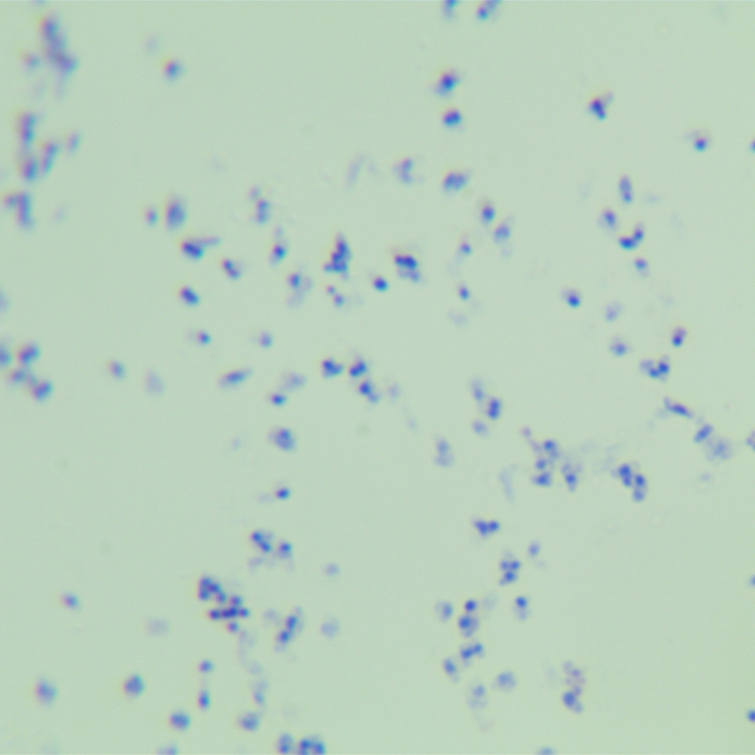 Intermediate mycobacteria-BNCC