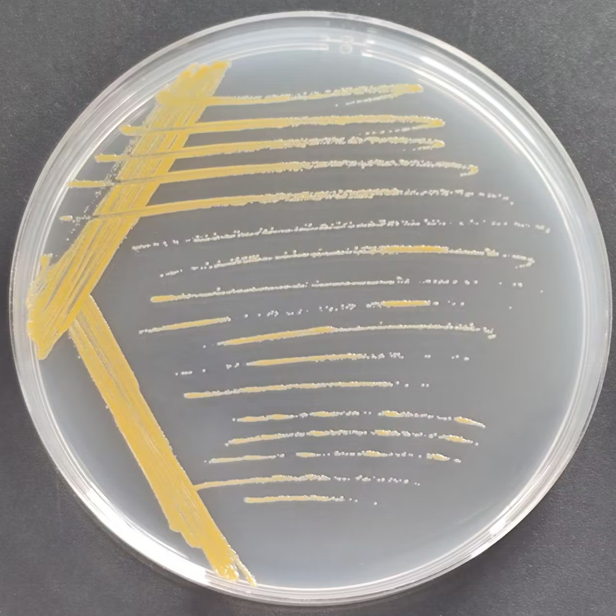 New golden mycobacteria-BNCC