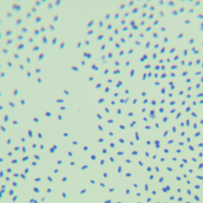 Mycobacterium Auburn-BNCC
