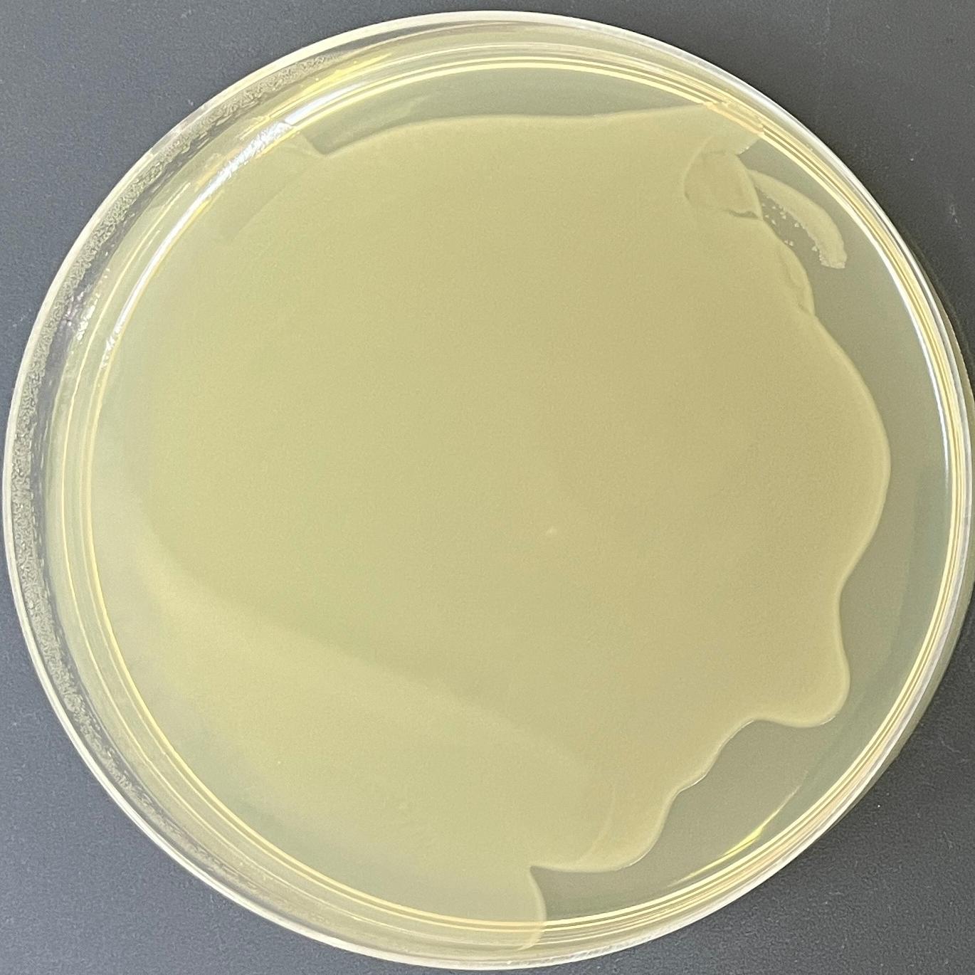 DH5 α (containing pLVX IRES puro plasmid) Escherichia coli-BNCC