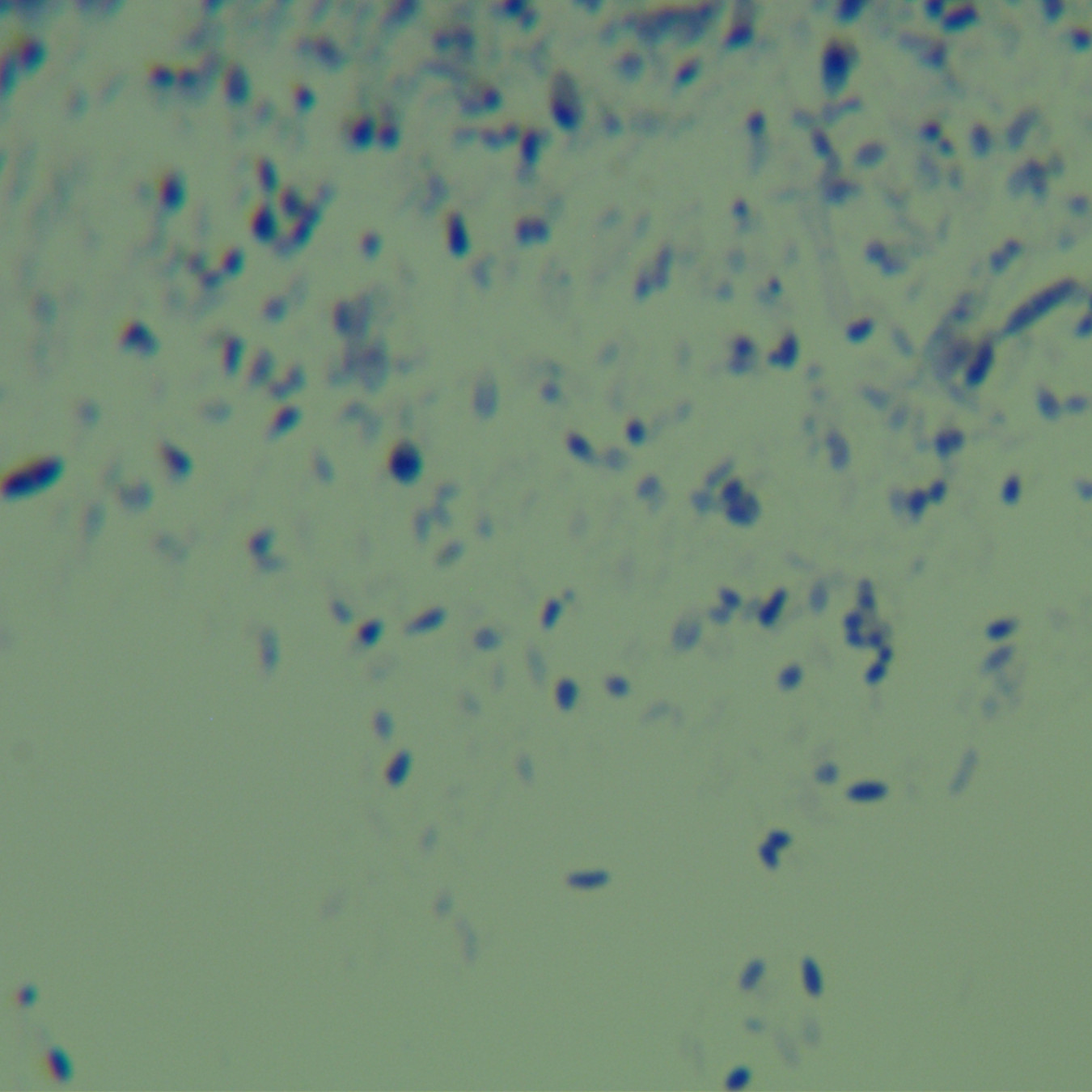 Kochi mycobacteria-BNCC