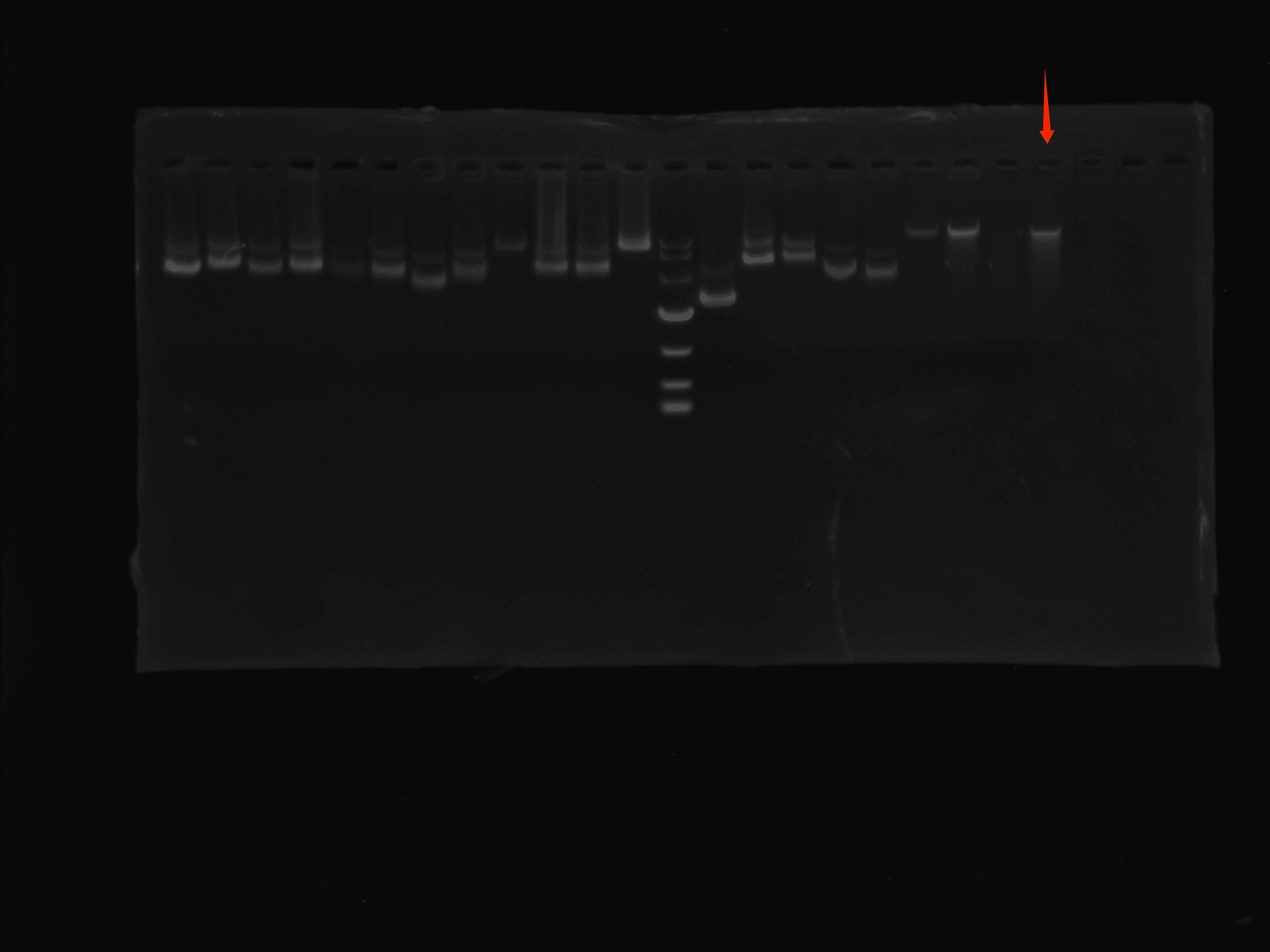 Mycobacterium avium avian subspecies-BNCC