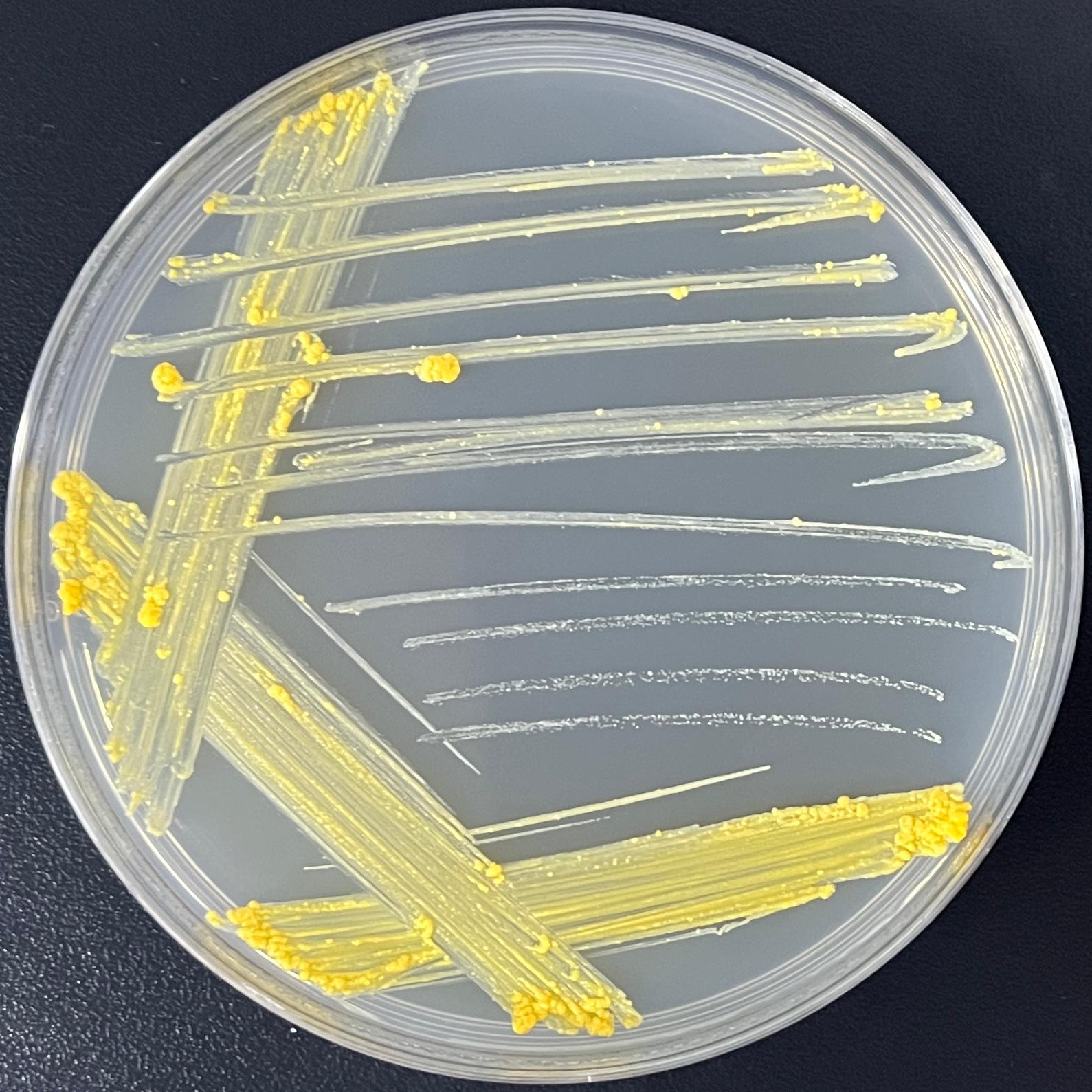 Mycobacterium bovis-BNCC