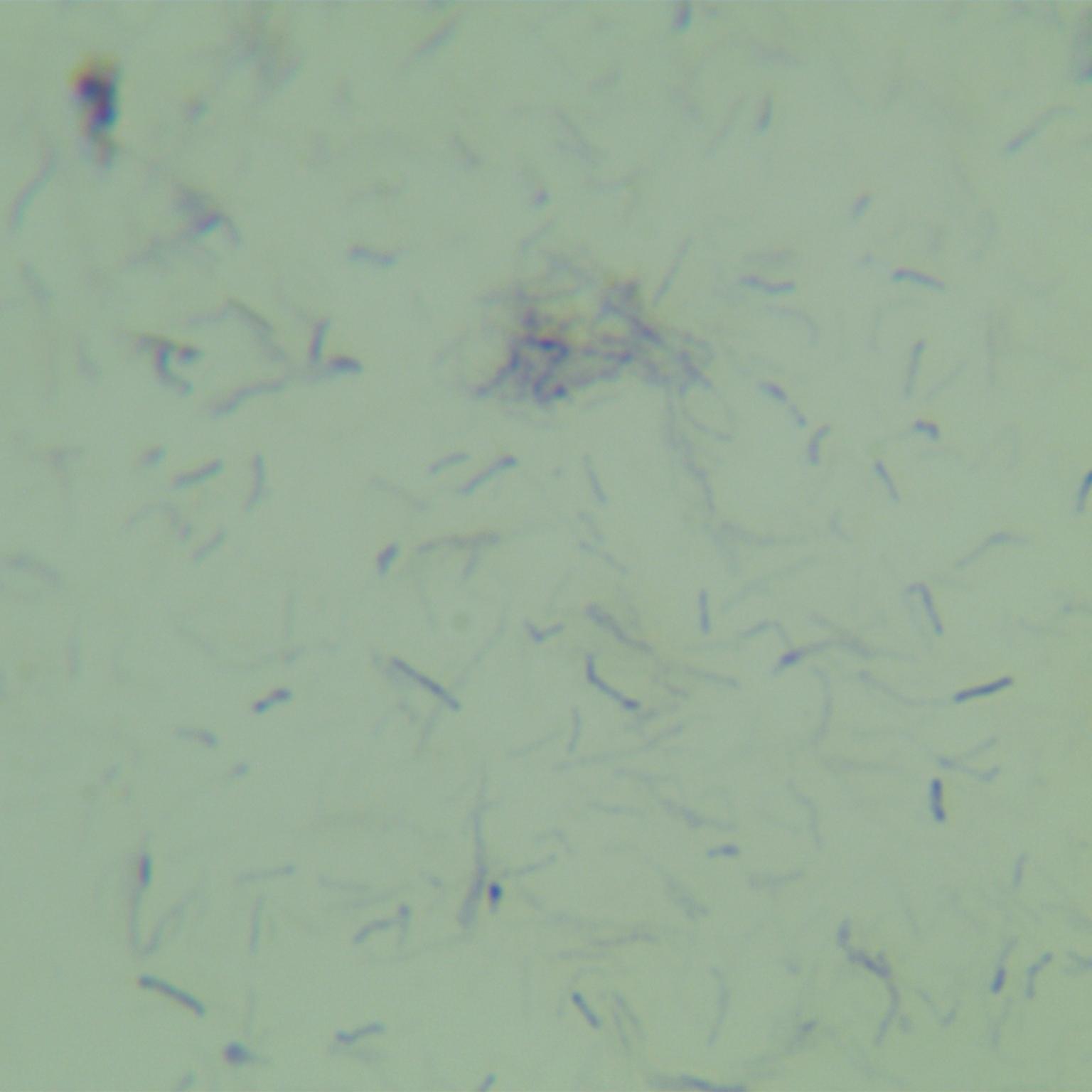 Mycobacterium bovis-BNCC