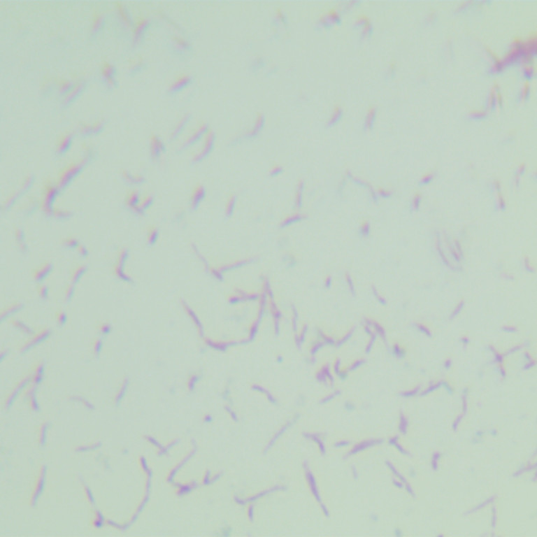 Mycobacterium bovis-BNCC