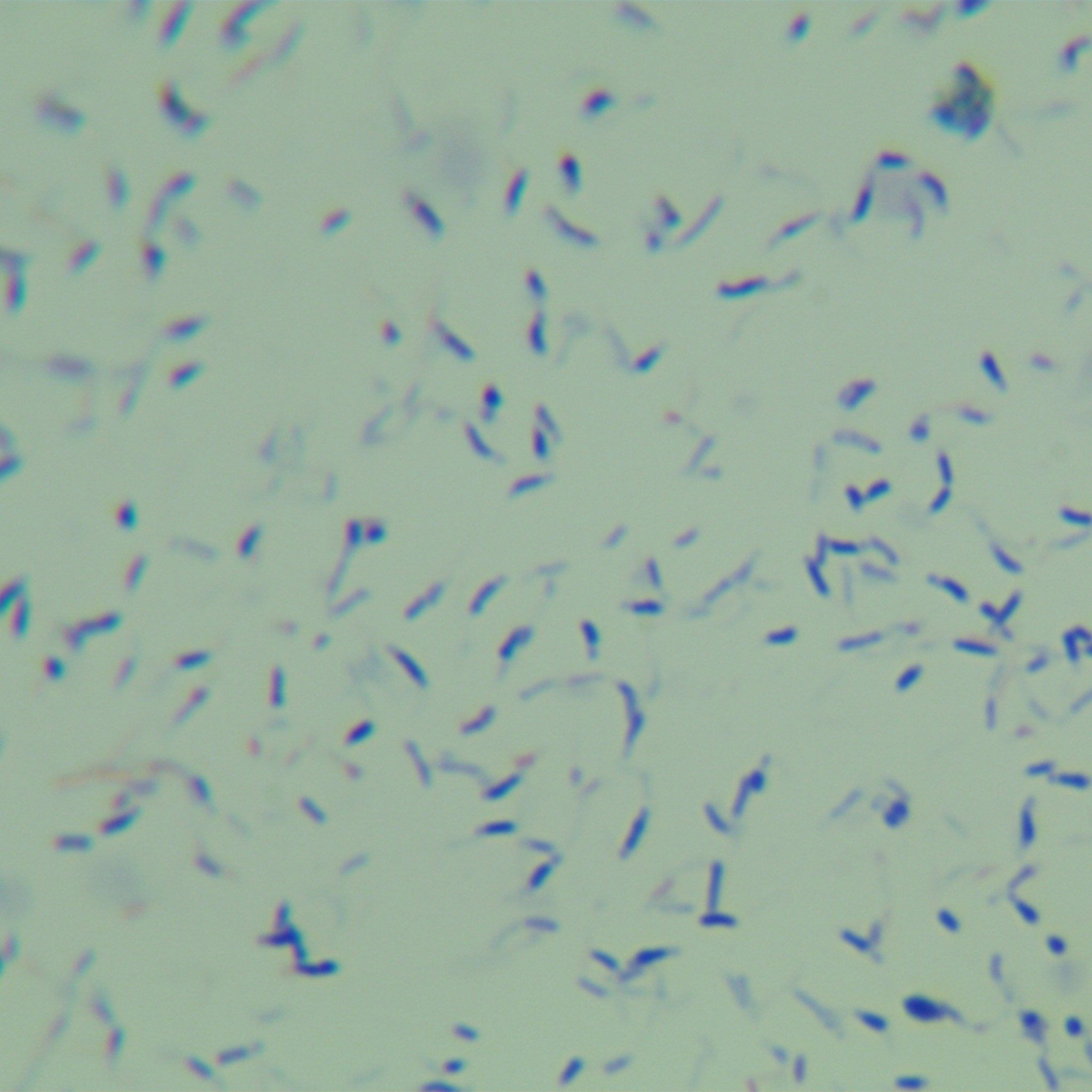 Occasional mycobacteria subspecies of acetamide-BNCC
