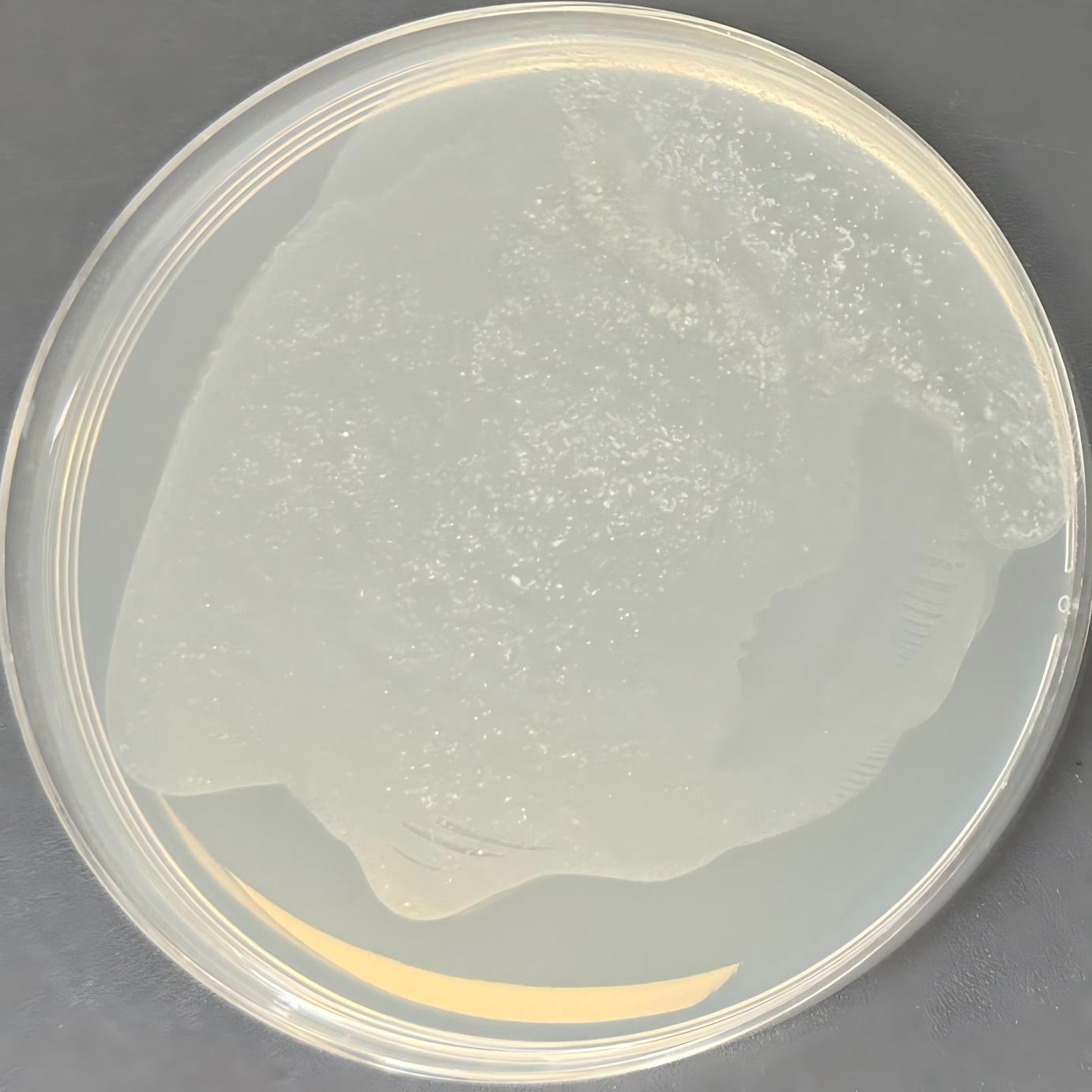 Sheng Wang Mycobacterium-BNCC