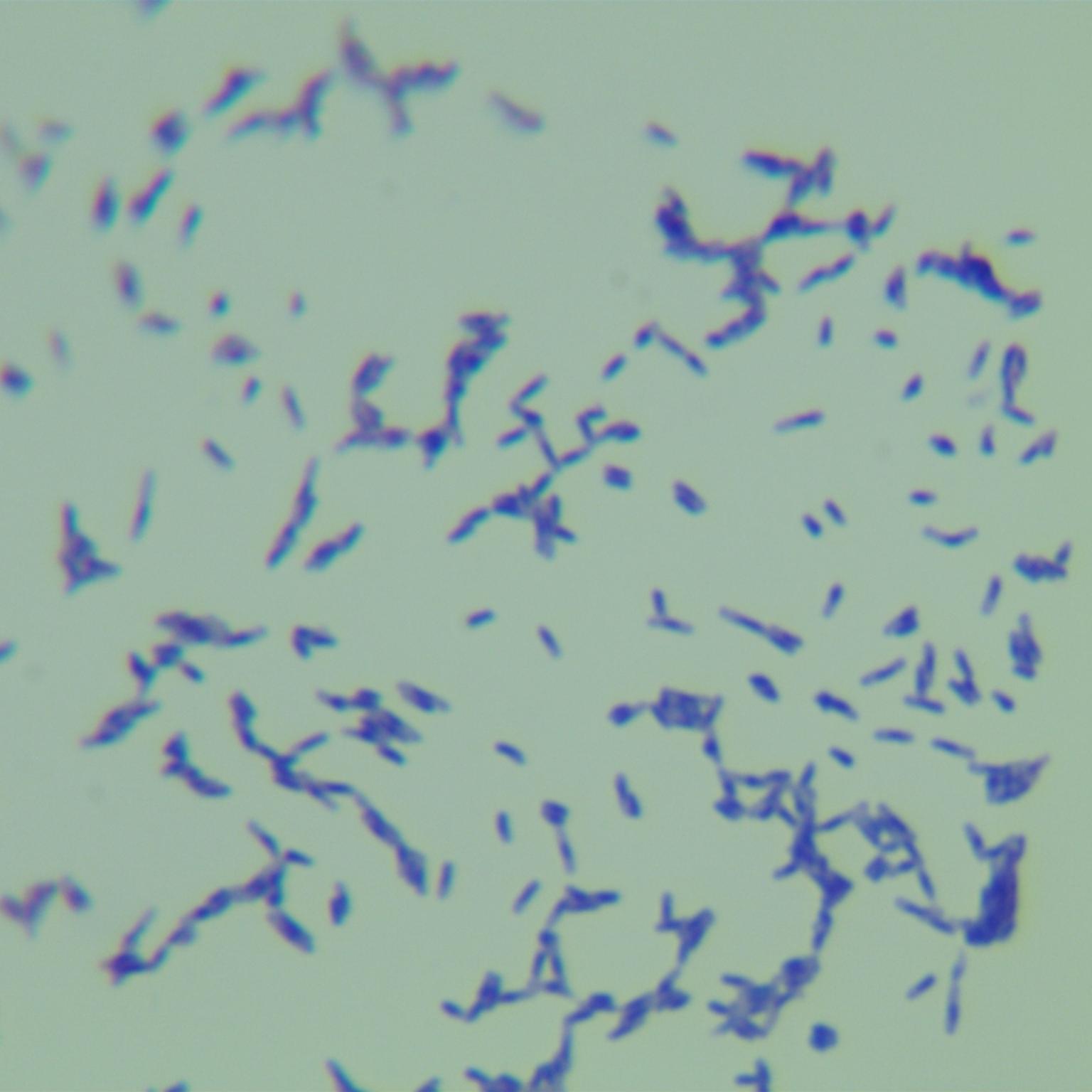 Sheng Wang Mycobacterium-BNCC