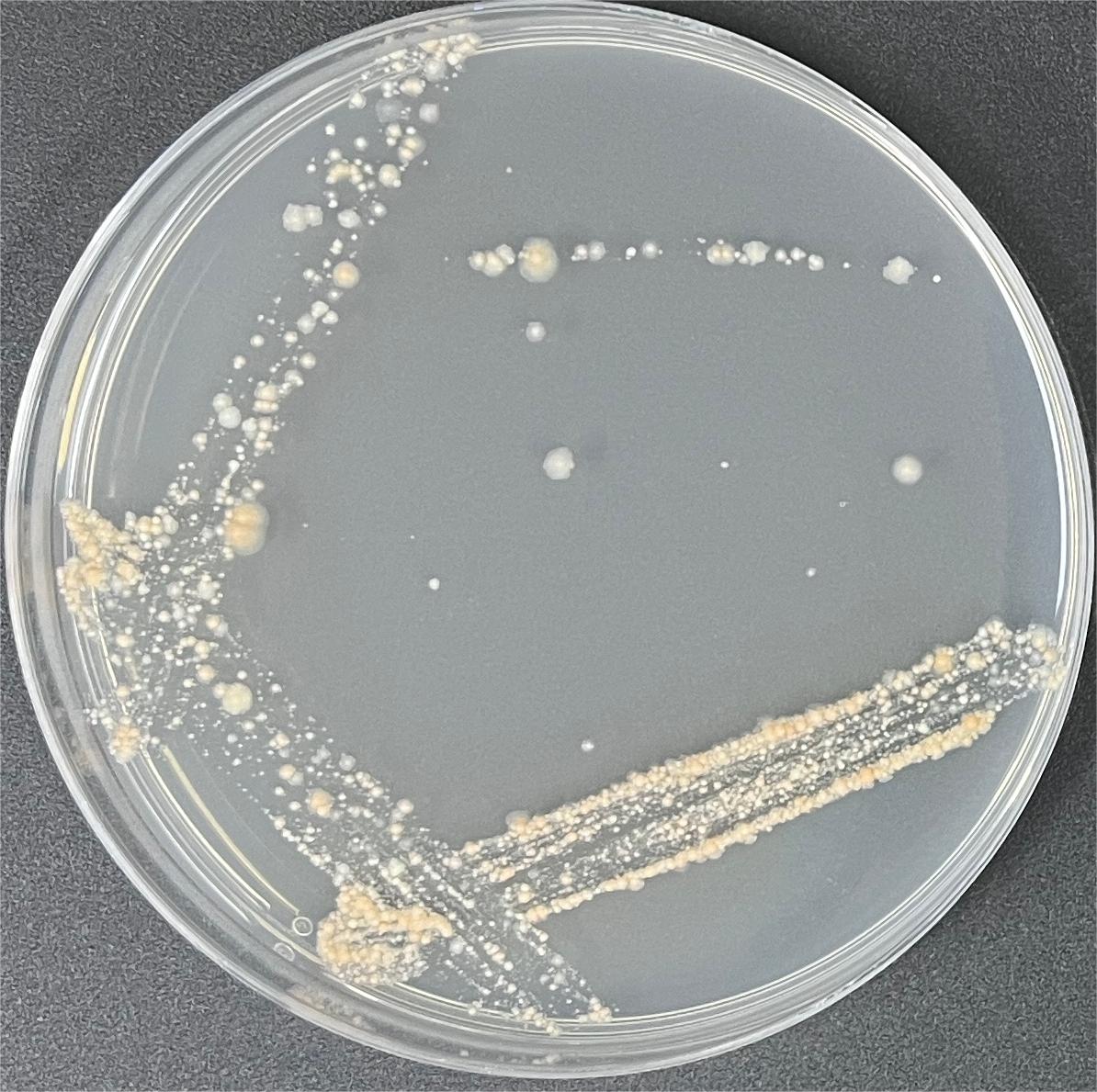 Irish mycobacteria-BNCC