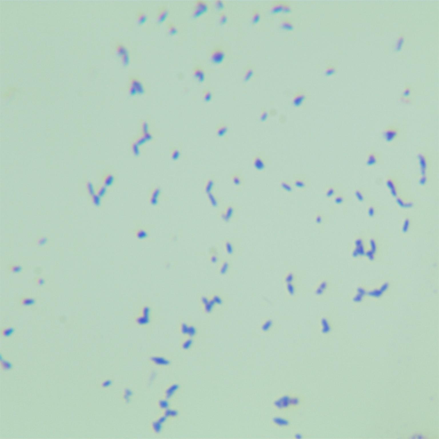 Irish mycobacteria-BNCC