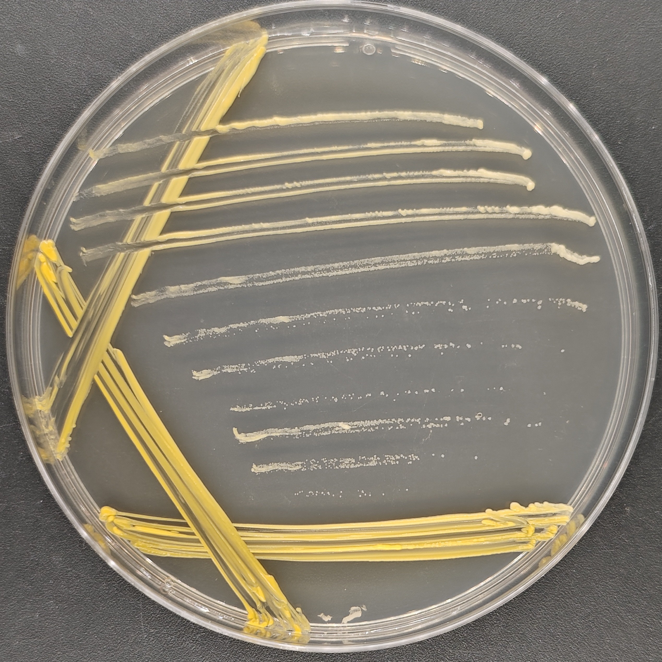 Asian mycobacteria-BNCC