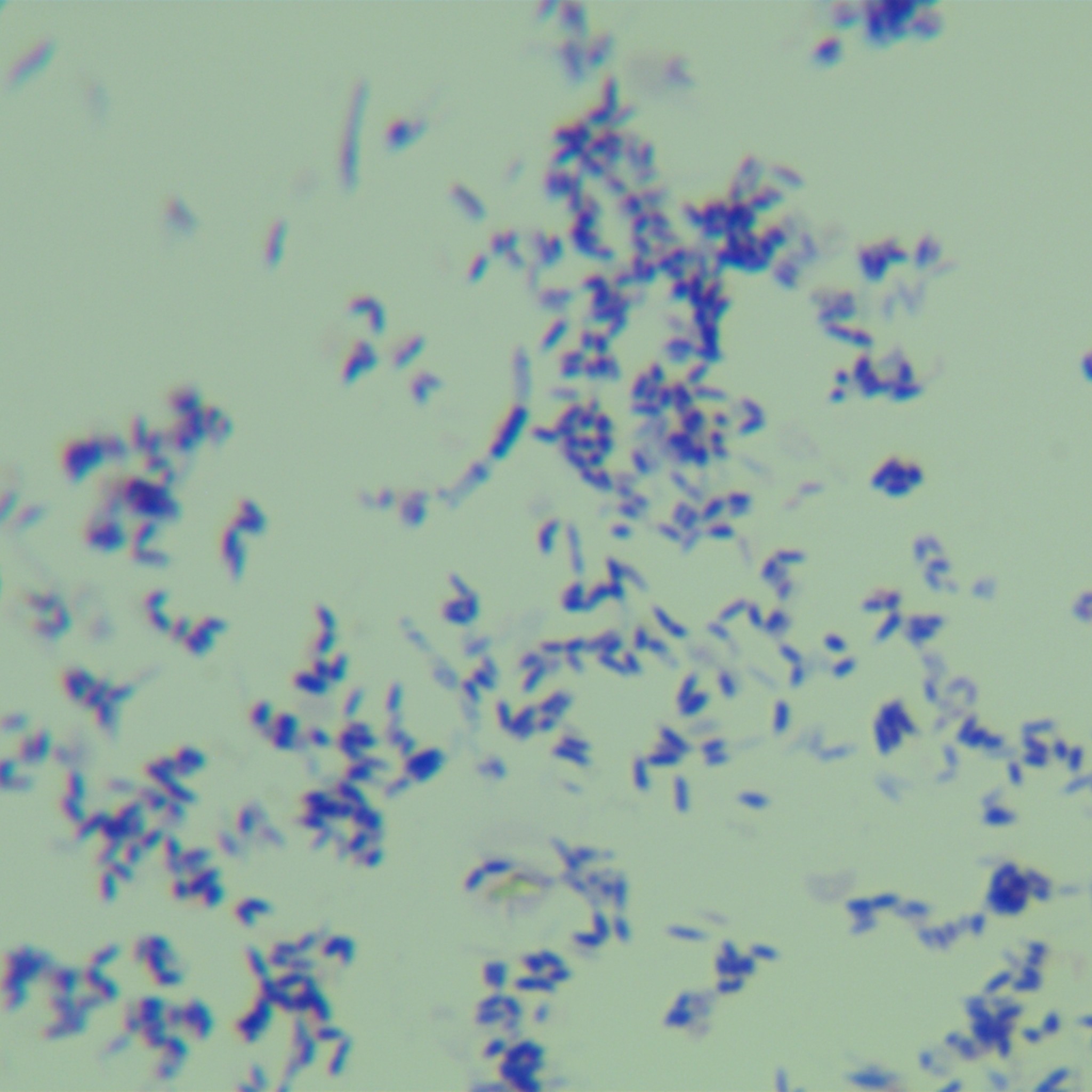 Asian mycobacteria-BNCC