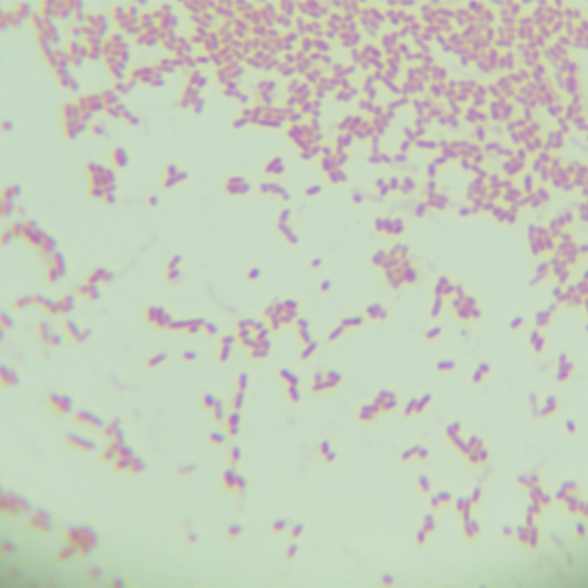 Shigella flexneri-BNCC