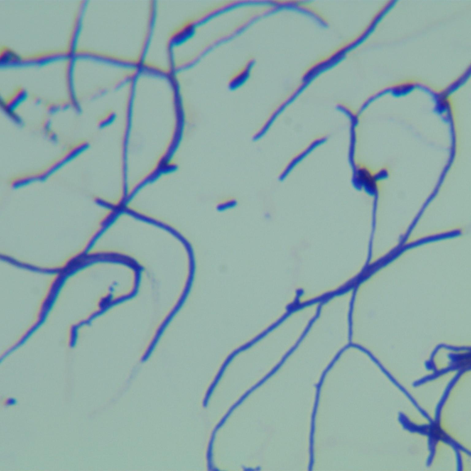Streptomyces cracking subspecies-BNCC