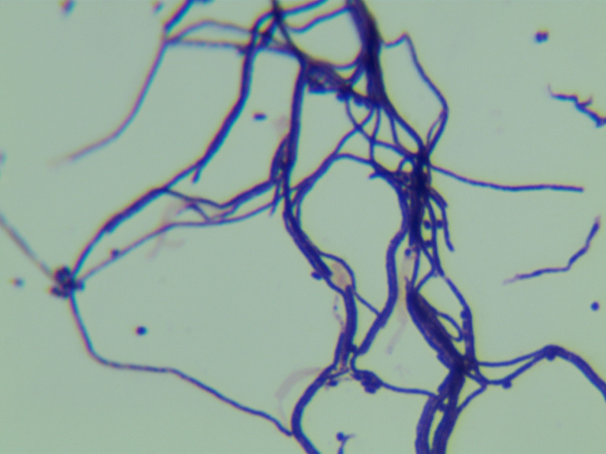 Grey Streptomyces-BNCC