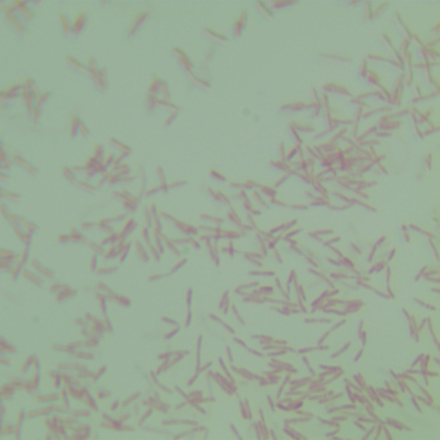 Birmingham Legionella-BNCC