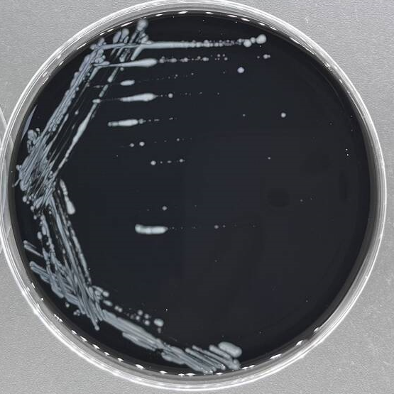 Birmingham Legionella-BNCC