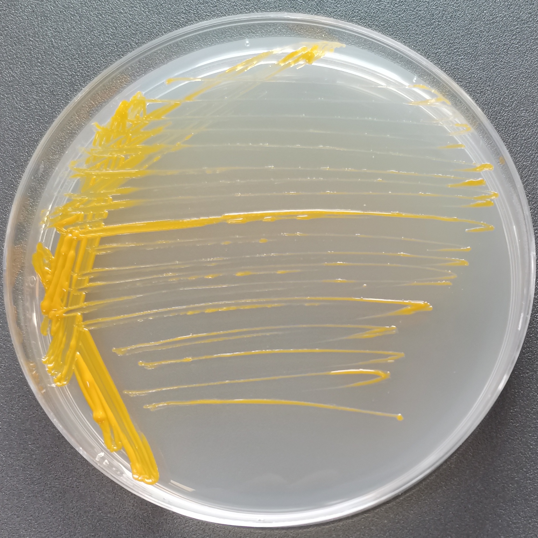 Mycobacterium parahaemolyticus-BNCC