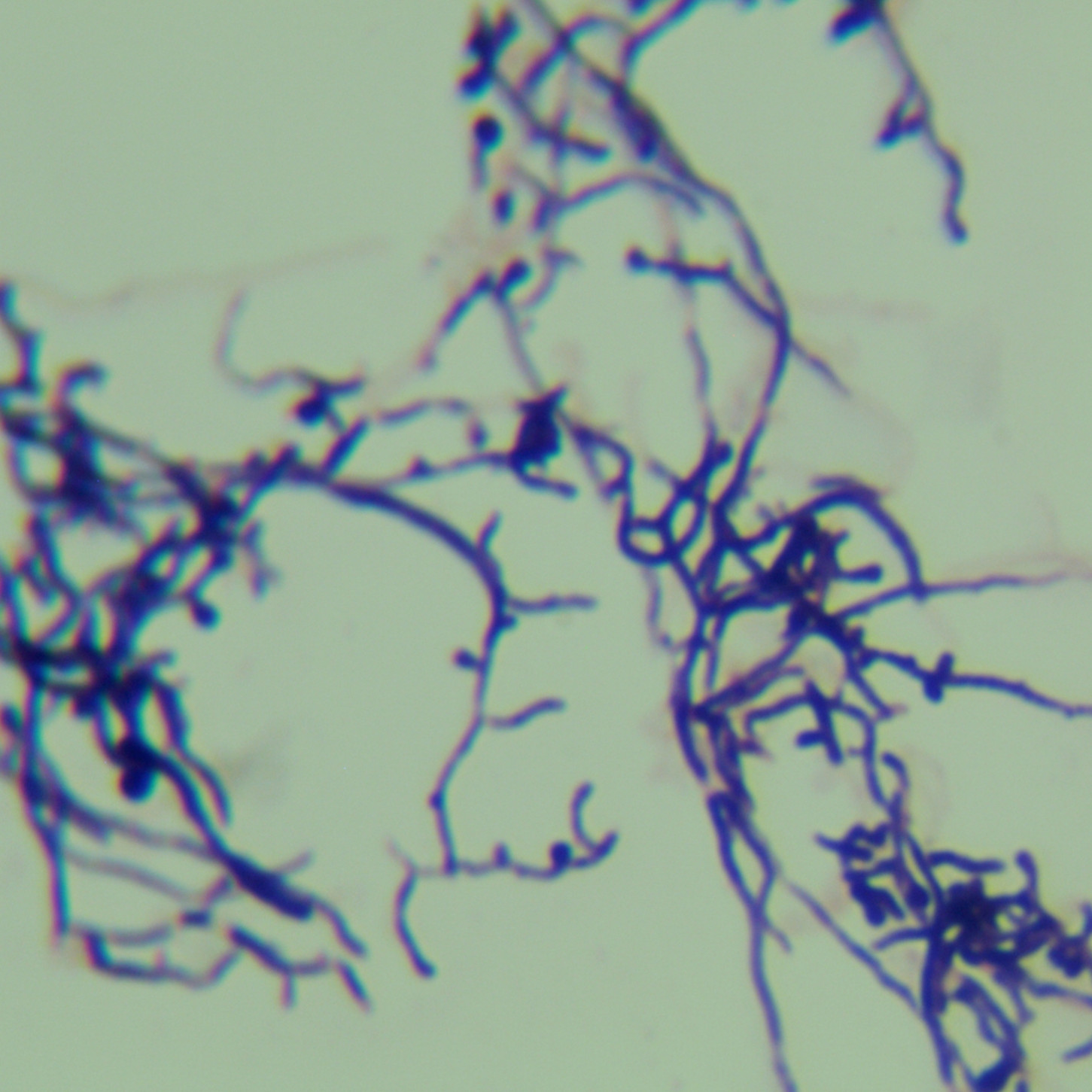 Daqu high-temperature actinomycetes-BNCC