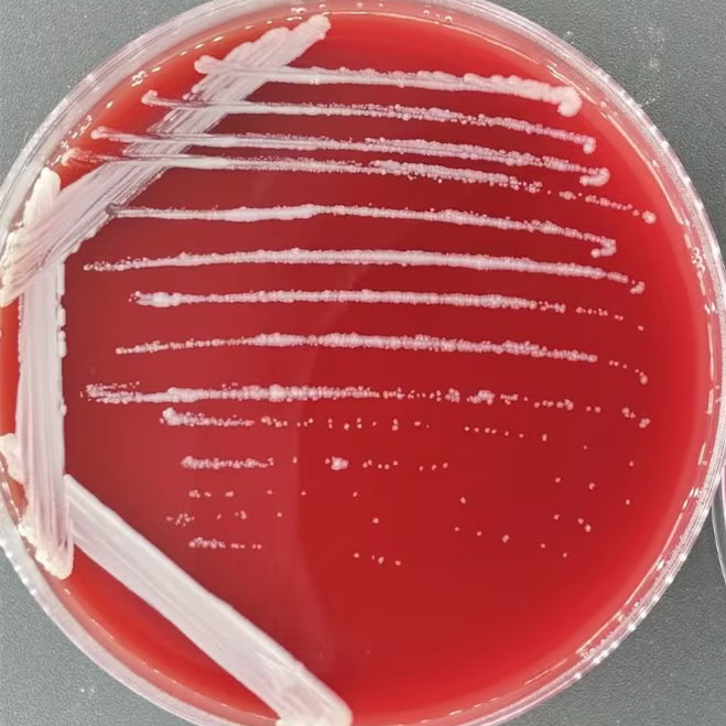 Wolinski mycobacteria-BNCC