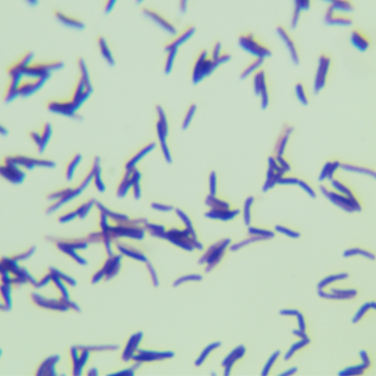 Wolinski mycobacteria-BNCC