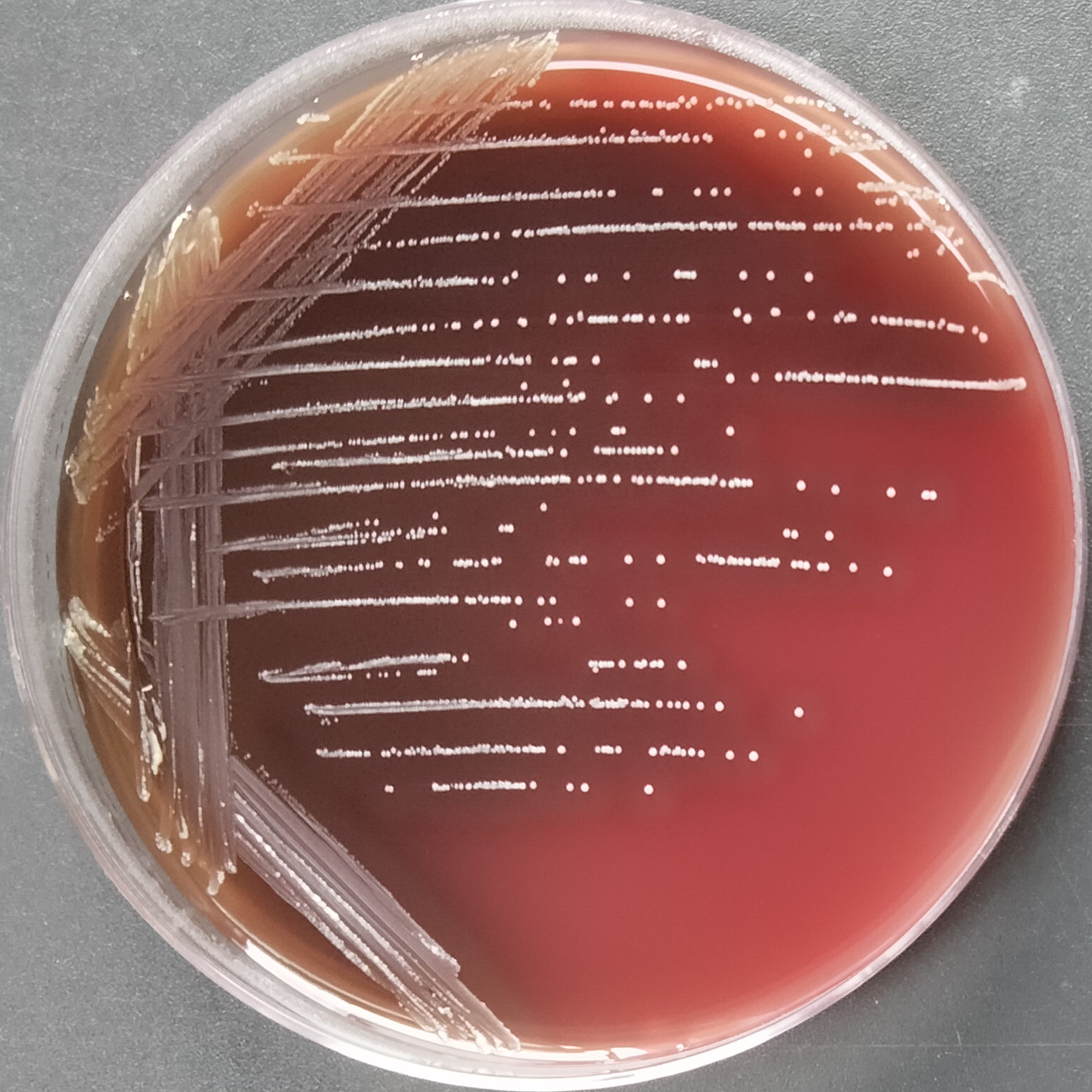 Streptococcus pyogenes-BNCC