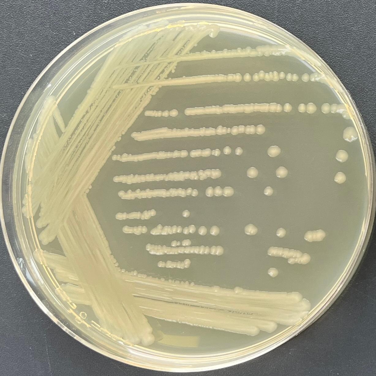 Ferguson Escherichia coli-BNCC